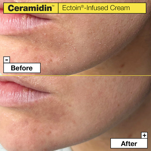 Ceramidin Ectoin Infused Cream 50ml